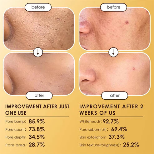 Moolinse Peel Shot P5 Exfoliant Ampoule (Pack of 2)