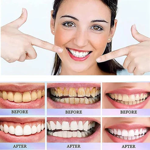 Oralhoe - Nicotinamide Dazzle White Toothpaste (Original)