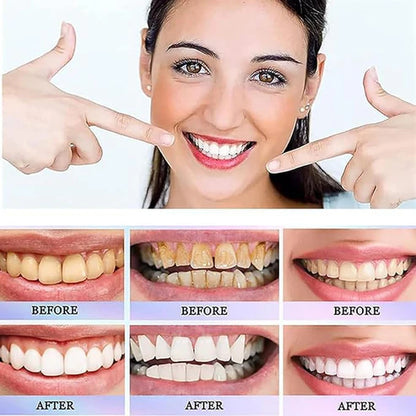 Oralhoe - Nicotinamide Dazzle White Toothpaste (Original)